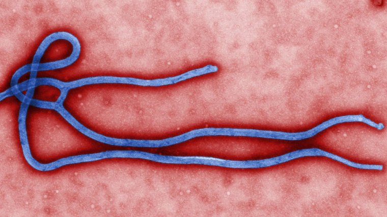 tipos de virus humanos que existen