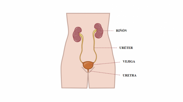 Que sintomas tiene la infeccion de orina