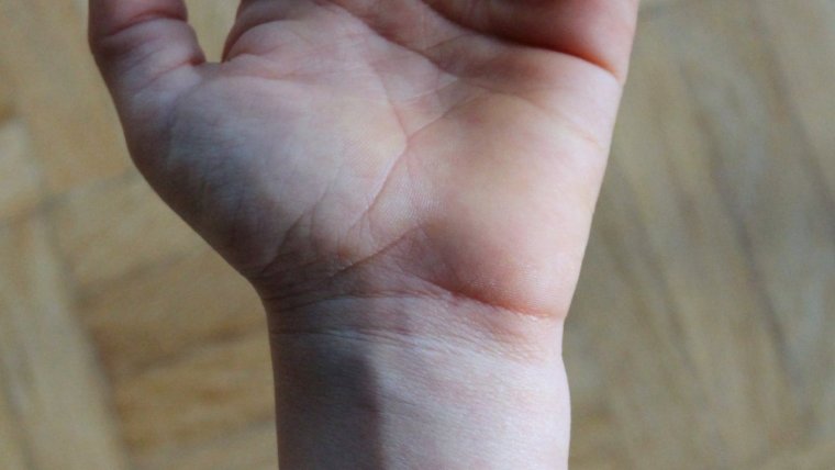 vena principal del cuerpo humano