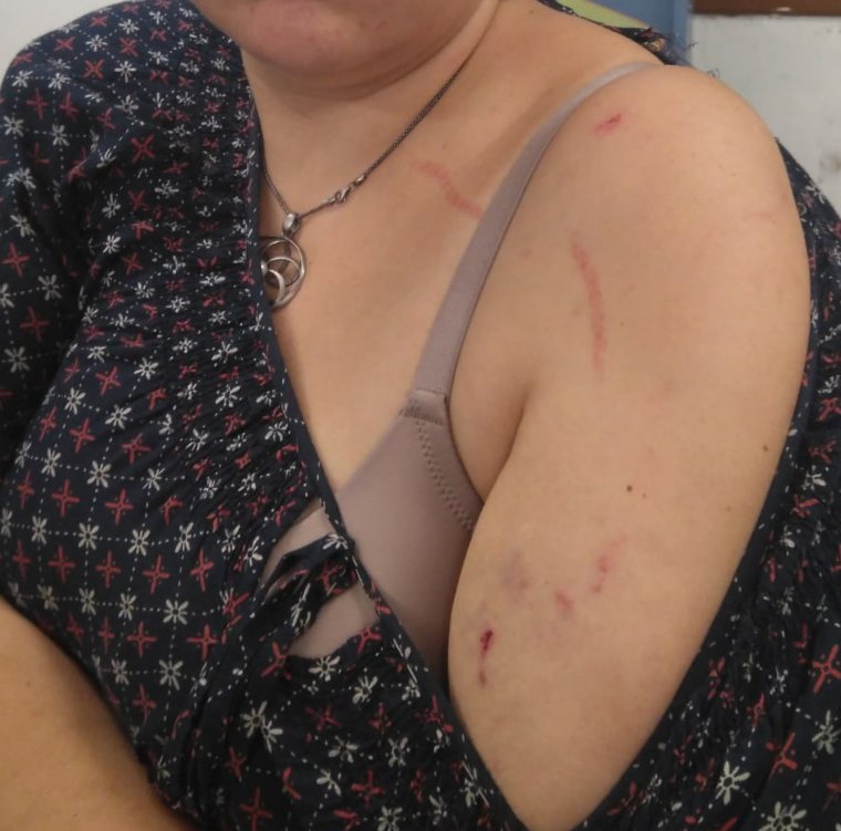 L'Eva, agredida a Torrefarrera per posar llaços grocs
