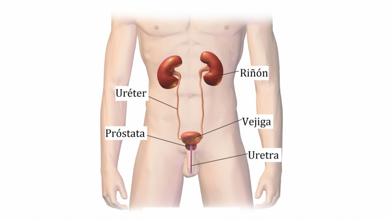 que produce la infeccion urinaria