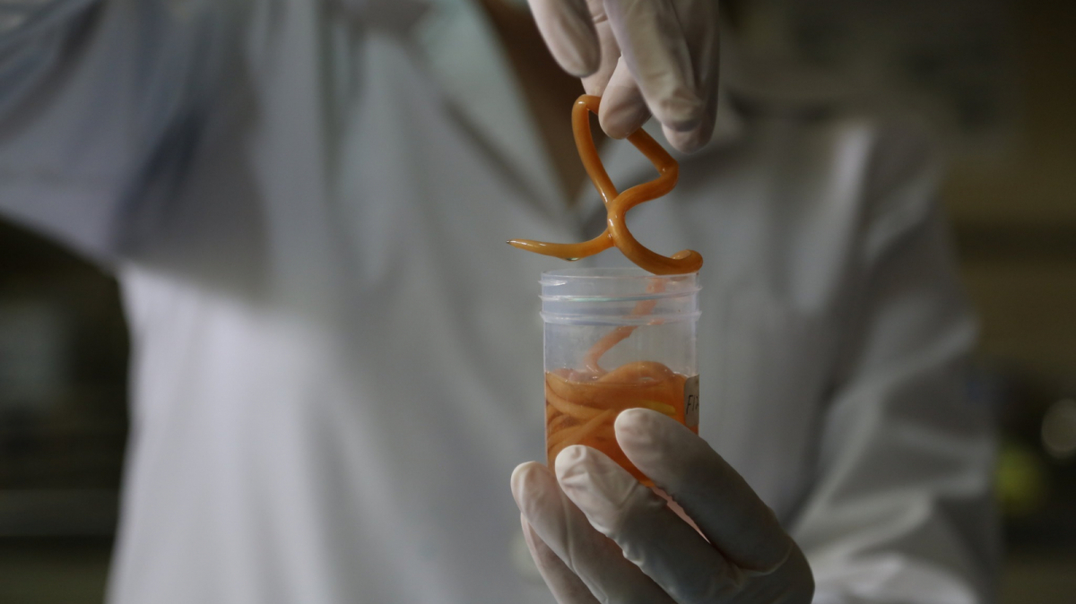 causas gusanos intestinales