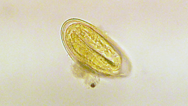 sintomas que causan las lombrices intestinales