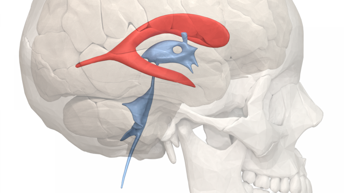 Enfermedades asociadas con hipertensión intracraneal