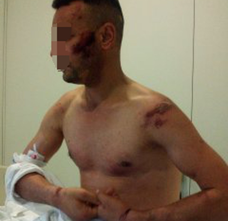 El conductor kamikaze detingut a Cambrils denuncia vuit mossos per suposades lesions