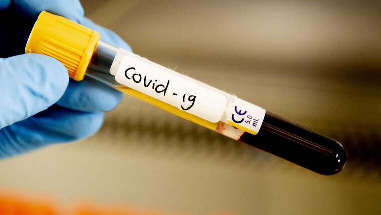 Imatge d'una mostra de sang per testar el covid-19 el marÃ§ de 2020
