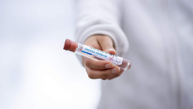 Prova del coronavirus