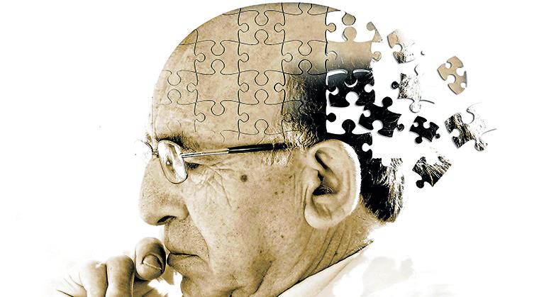 Les persones amb alzheimer processen de forma menys eficaç les cares en posició normal que els rostres invertits i els cotxes.