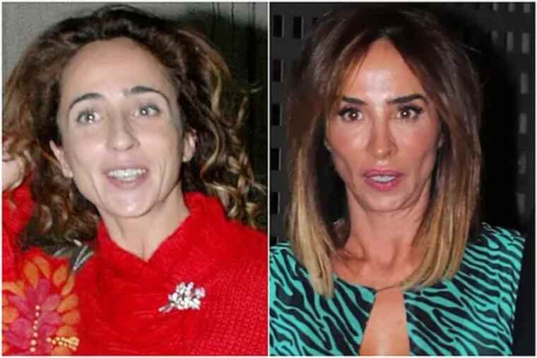 Collage de María Patiño abans i després de les seves múltiples operacions