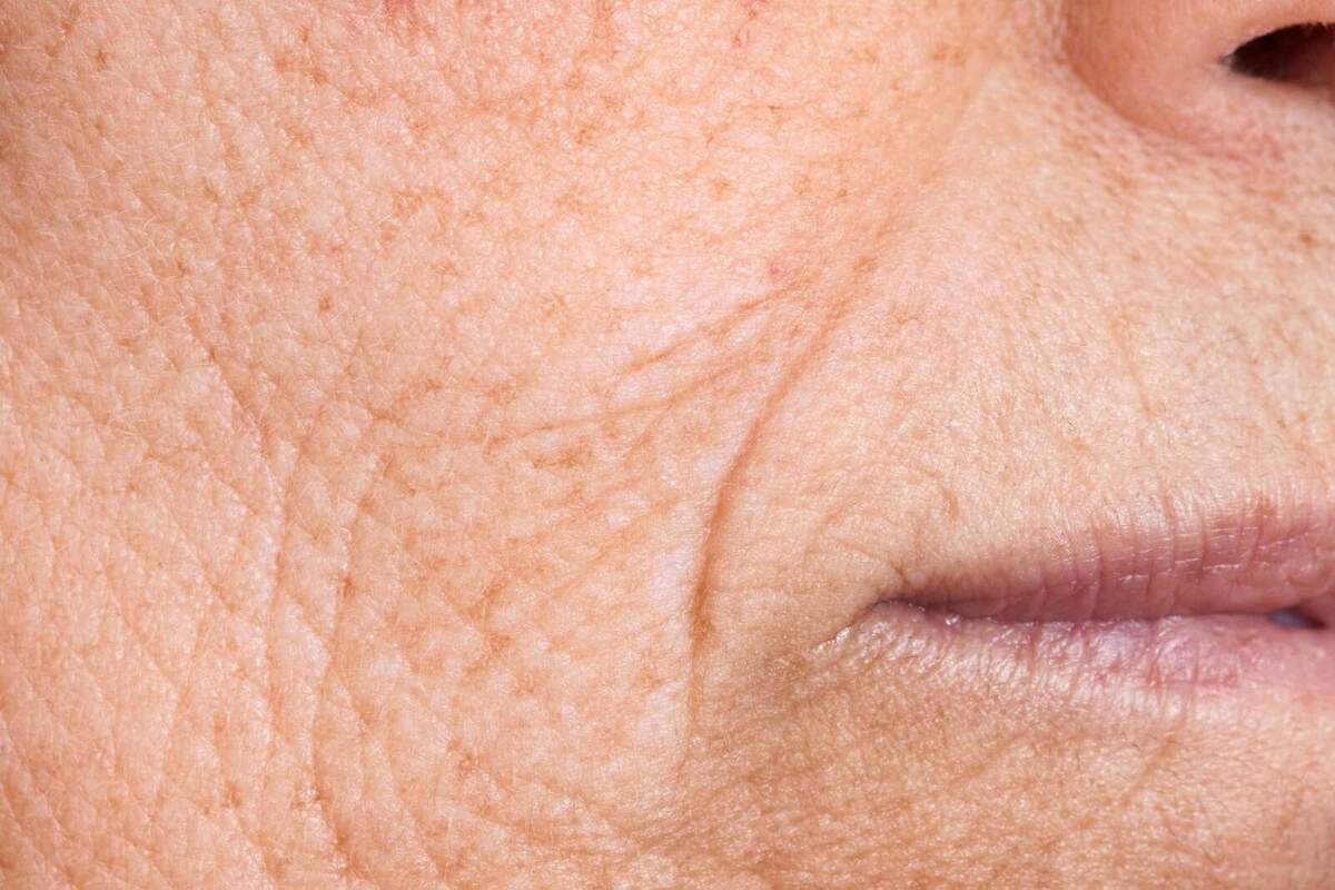 Imatge de la pell d'una persona.
