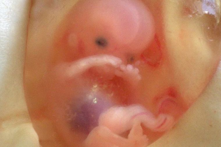 Imatge d'un fetus després d'un avortament