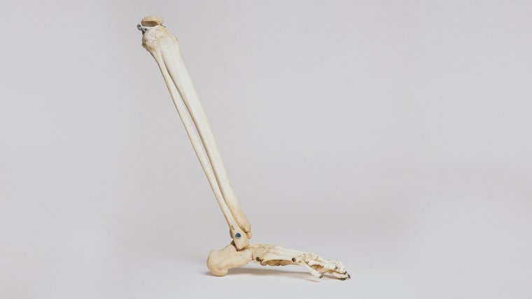 Some of the strongest bones are in the leg.