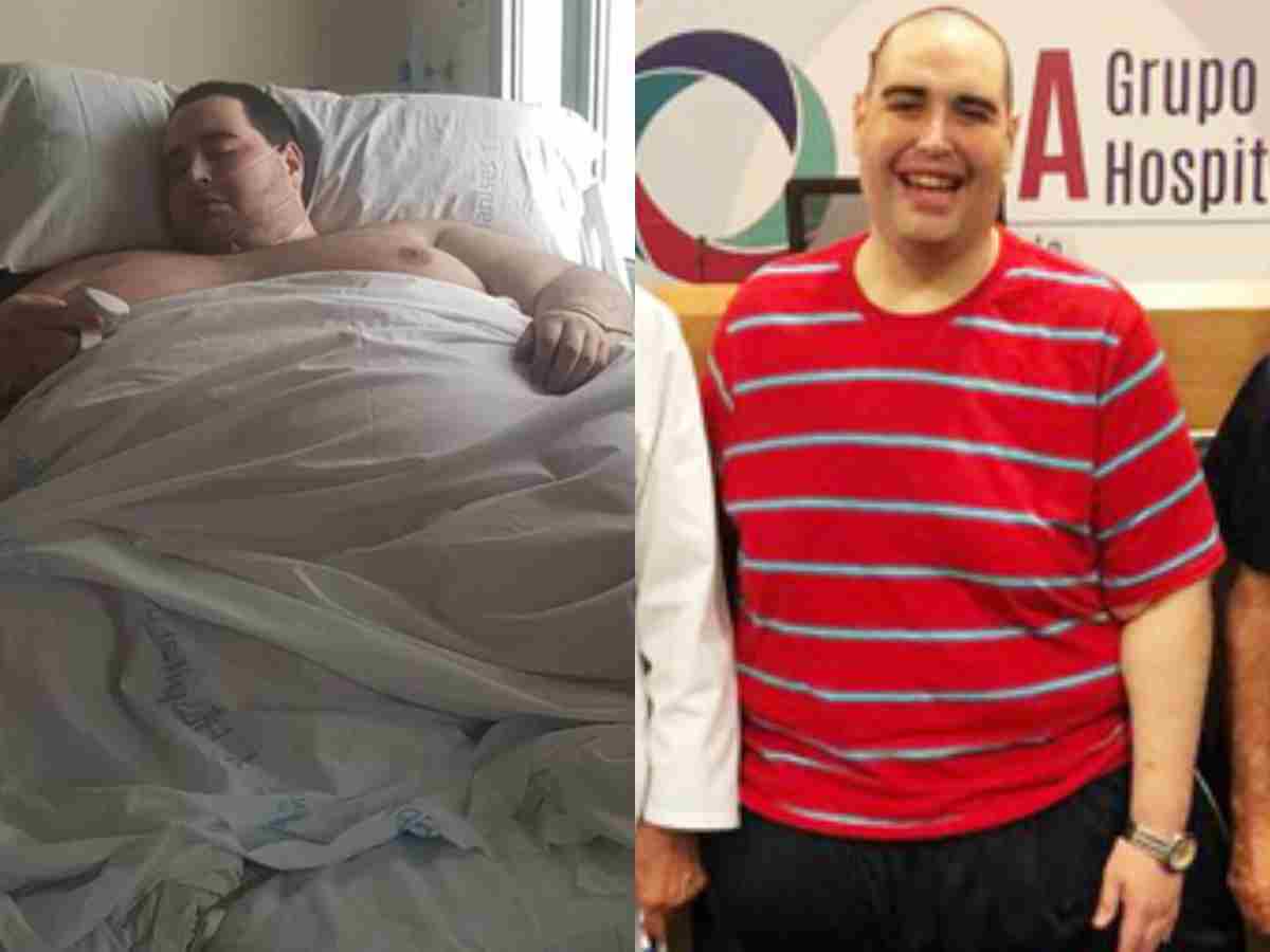 💪Teo, el joven español que ha perdido 242 kilos tras casi perder la vida