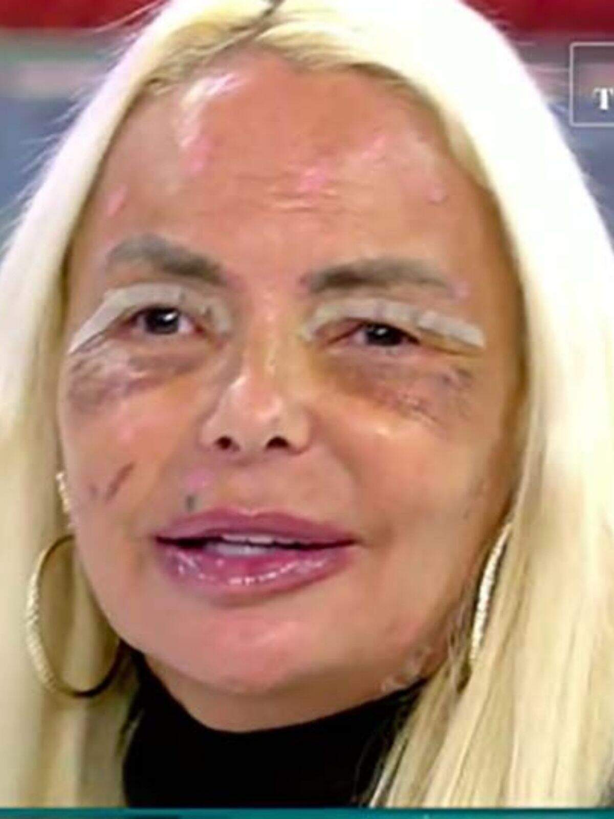 Leticia Sabater con marcas de sus operaciones y pelo rubio Leticia Sabater con marcas de sus operaciones y pelo rubio