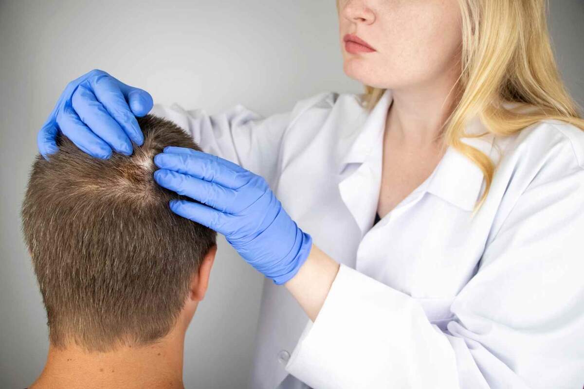 A dermatologist checking the scalp hair