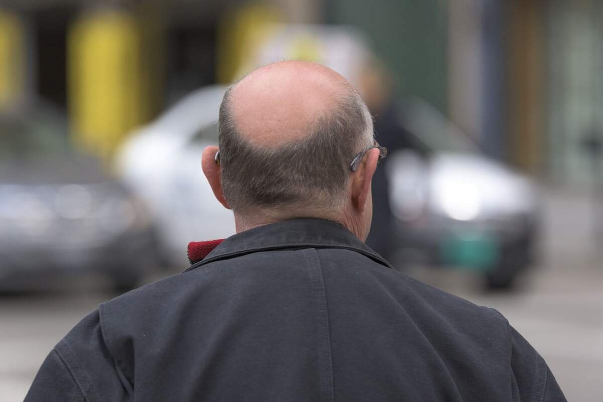 A man with a big bald spot in the middle of the street