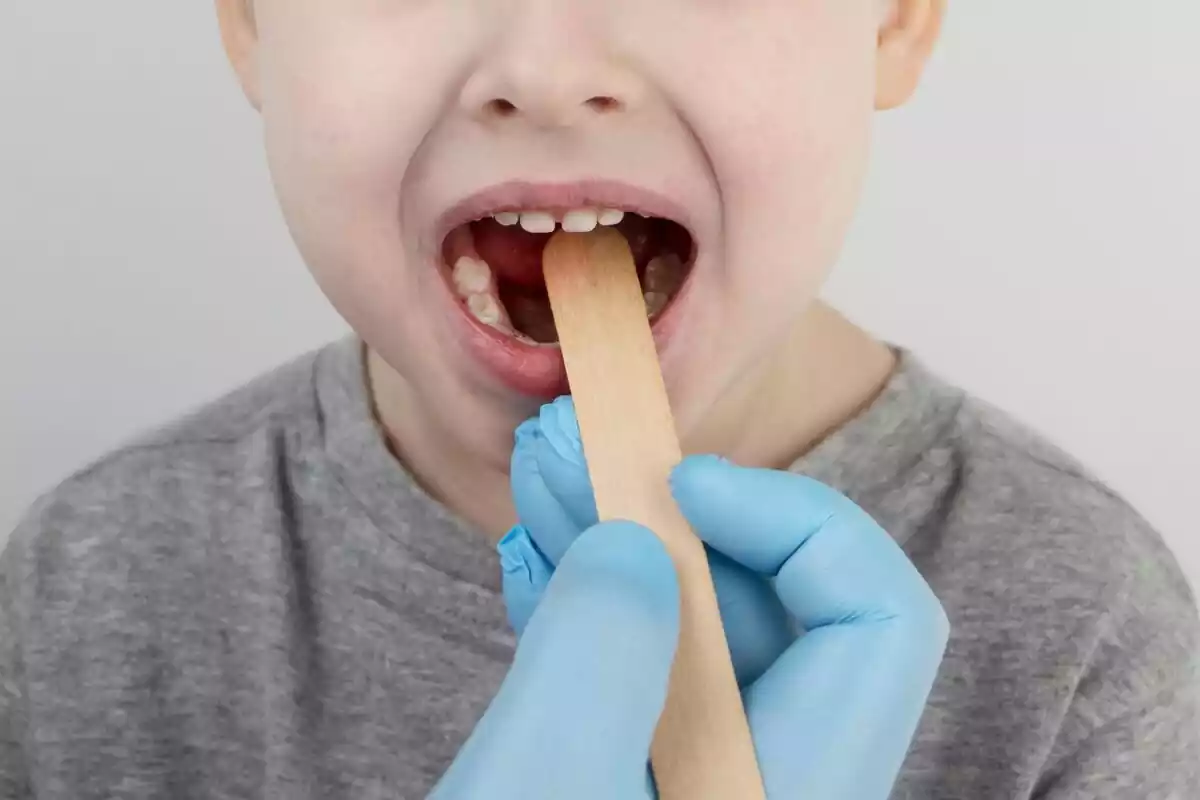 Niño con la boca abierta siendo examinado por un médico Niño con la boca abierta siendo examinado por un médico