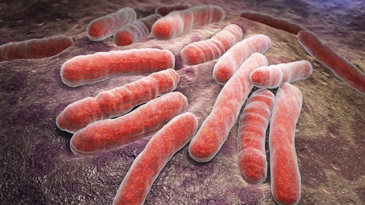 Tuberculosis: qué es, síntomas, causas y tratamiento