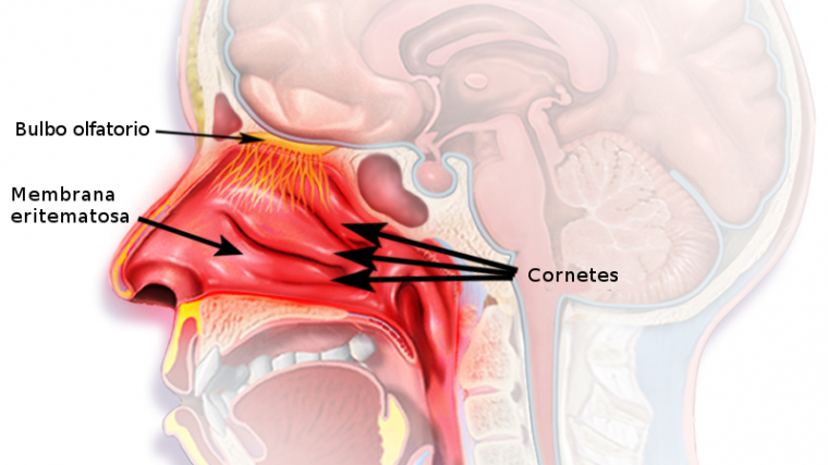 Rinitis: síntomas, tratamiento y relación con la sinusitis